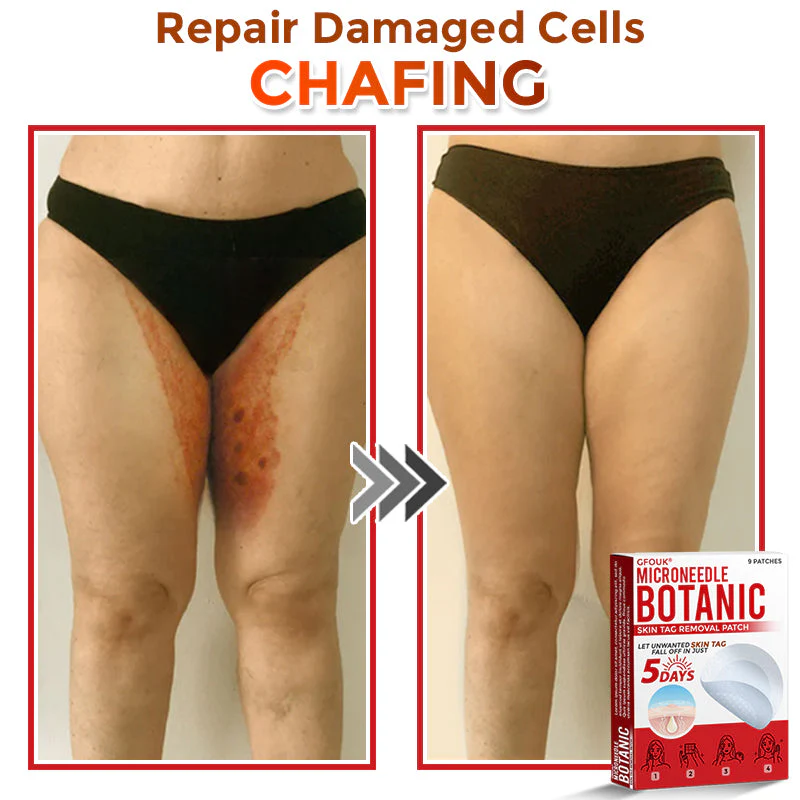 ✔GFOUK® MicroNeedle Botanic Skin Tag Removal Patch 🇺🇸 Made in the USA - Image 9