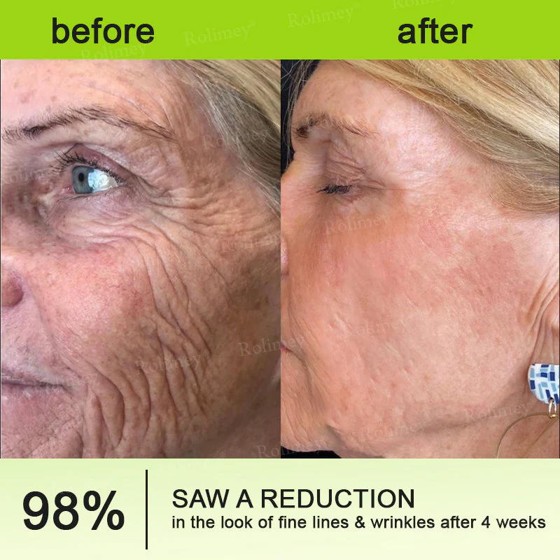 💞Made and shipped from the USA 💫Rolimey® Botox & Vita-A Retinol Shot Wrinkle-Lift Tightening cream - Last Day Promotion 70% OFF - Image 11