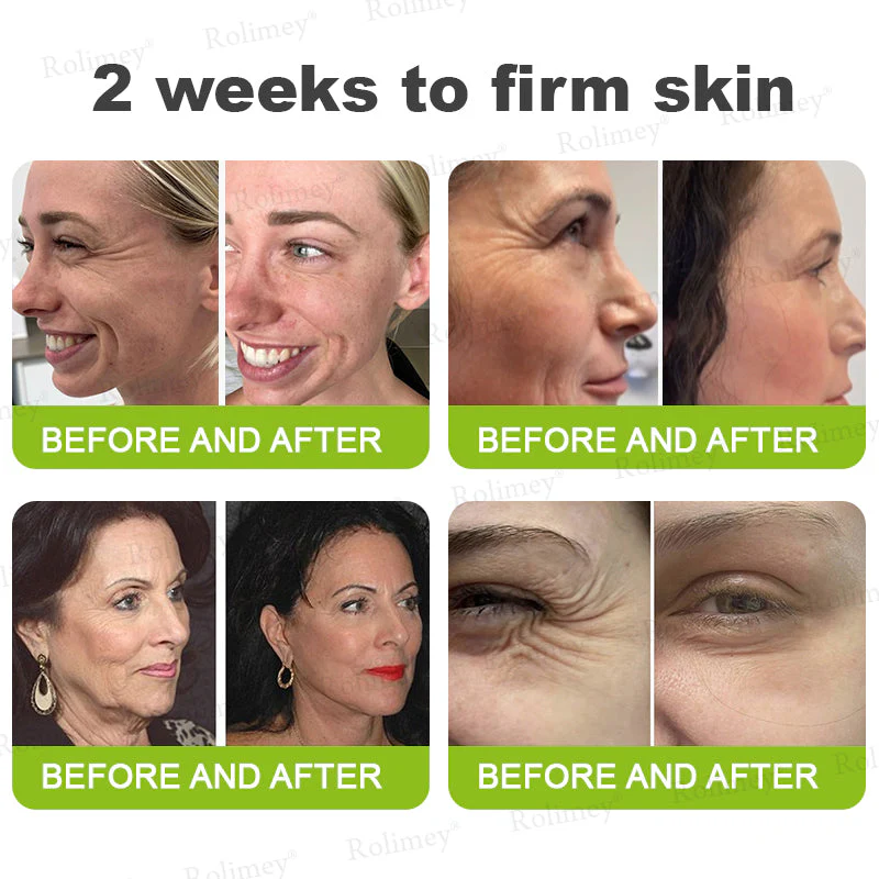 💞Made and shipped from the USA 💫Rolimey® Botox & Vita-A Retinol Shot Wrinkle-Lift Tightening cream - Last Day Promotion 70% OFF - Image 6
