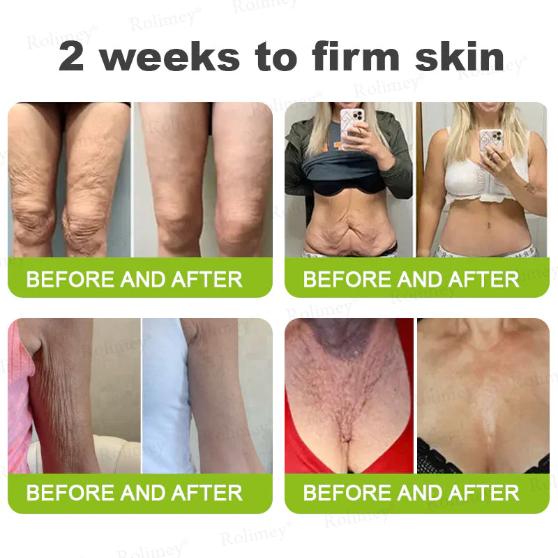 💞Made and shipped from the USA 💫Rolimey® Botox & Vita-A Retinol Shot Wrinkle-Lift Tightening cream - Last Day Promotion 70% OFF - Image 8