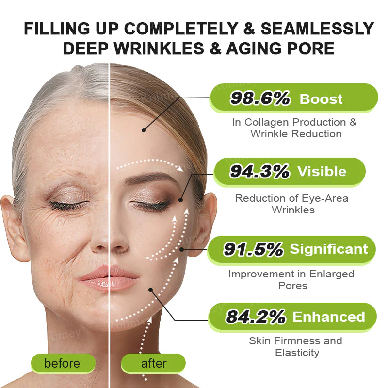 🥒Rolimey® Botox & Vita-A Retinol Shot Wrinkle-Lift Tightening cream - Last Day Promotion 70% OFF - Image 12