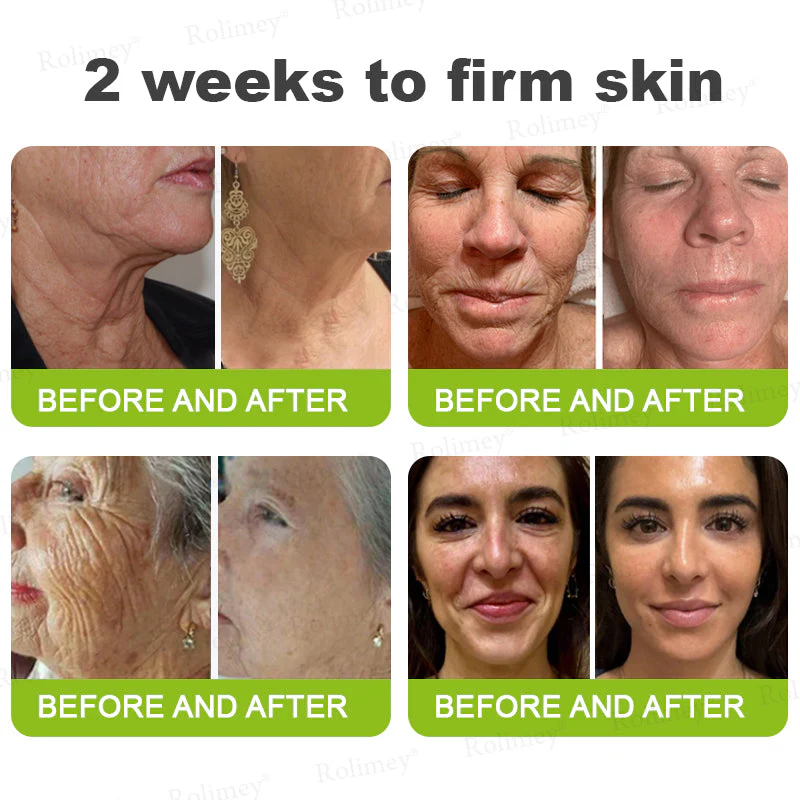 🥒Rolimey® Botox & Vita-A Retinol Shot Wrinkle-Lift Tightening cream - Last Day Promotion 70% OFF - Image 5