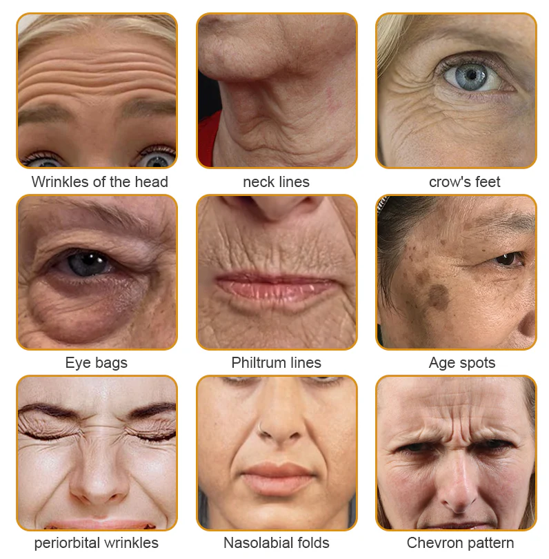 Made and Shipped from the USA✅ Furzero™ Botox Bee Venom Wrinkle Removal Cream-Last Day Promotion 70% OFF UPSELL - Image 3