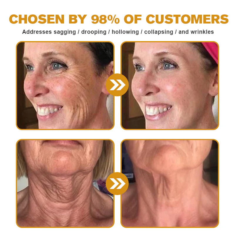 Made and Shipped from the USA✅ Furzero™ Botox Bee Venom Wrinkle Removal Cream-Last Day Promotion 70% OFF UPSELL - Image 6