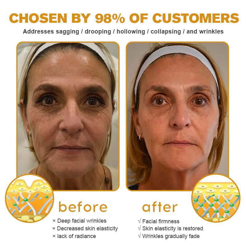 Made and Shipped from the USA✅ Furzero™ Botox Bee Venom Wrinkle Removal Cream-Last Day Promotion 70% OFF UPSELL - Image 7