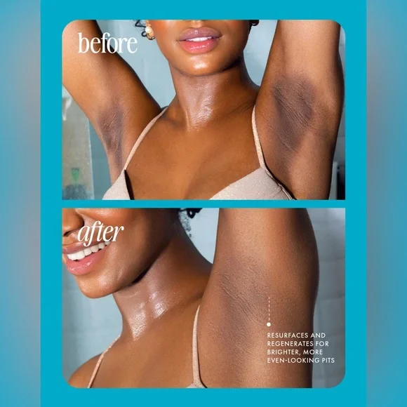 5-Second Post-Hair Removal Rescue: Bumps Fade, Skin Glows! Glass Smooth Oil - Image 6