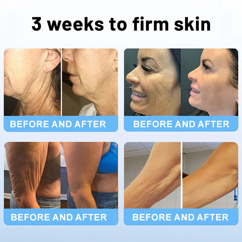 Flysmus™ Collagen Peptides FIRMING SERUM - Image 4