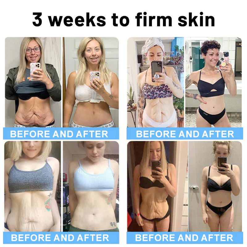 Flysmus™ Collagen Peptides FIRMING SERUM - Image 5