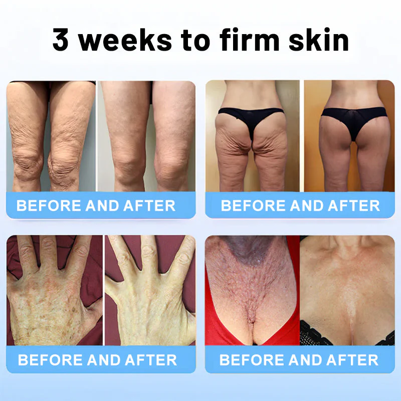 Flysmus™ Collagen Peptides FIRMING SERUM - Image 6