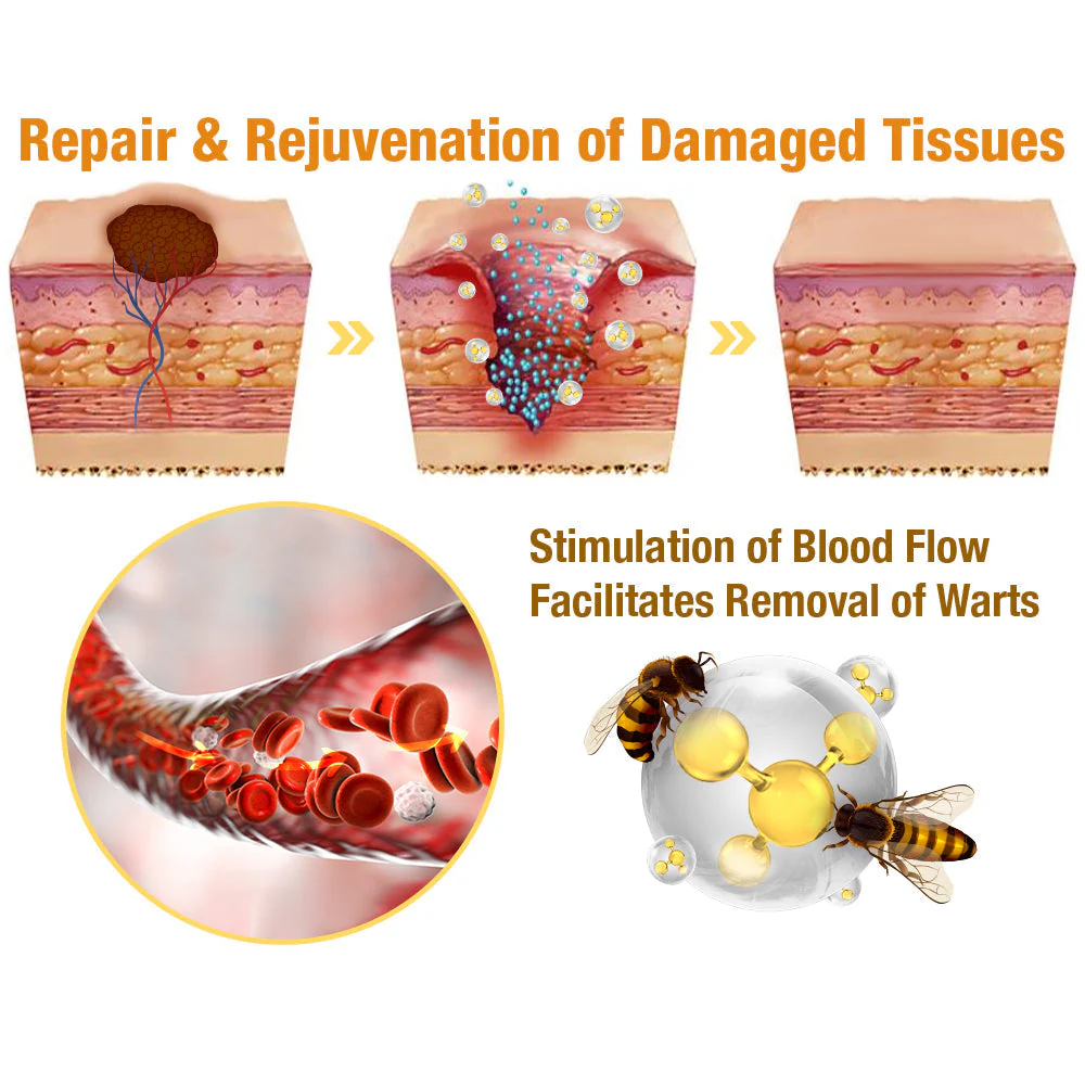 flysmus™ TagRecede Bee Venom Treatment Spray - Image 3