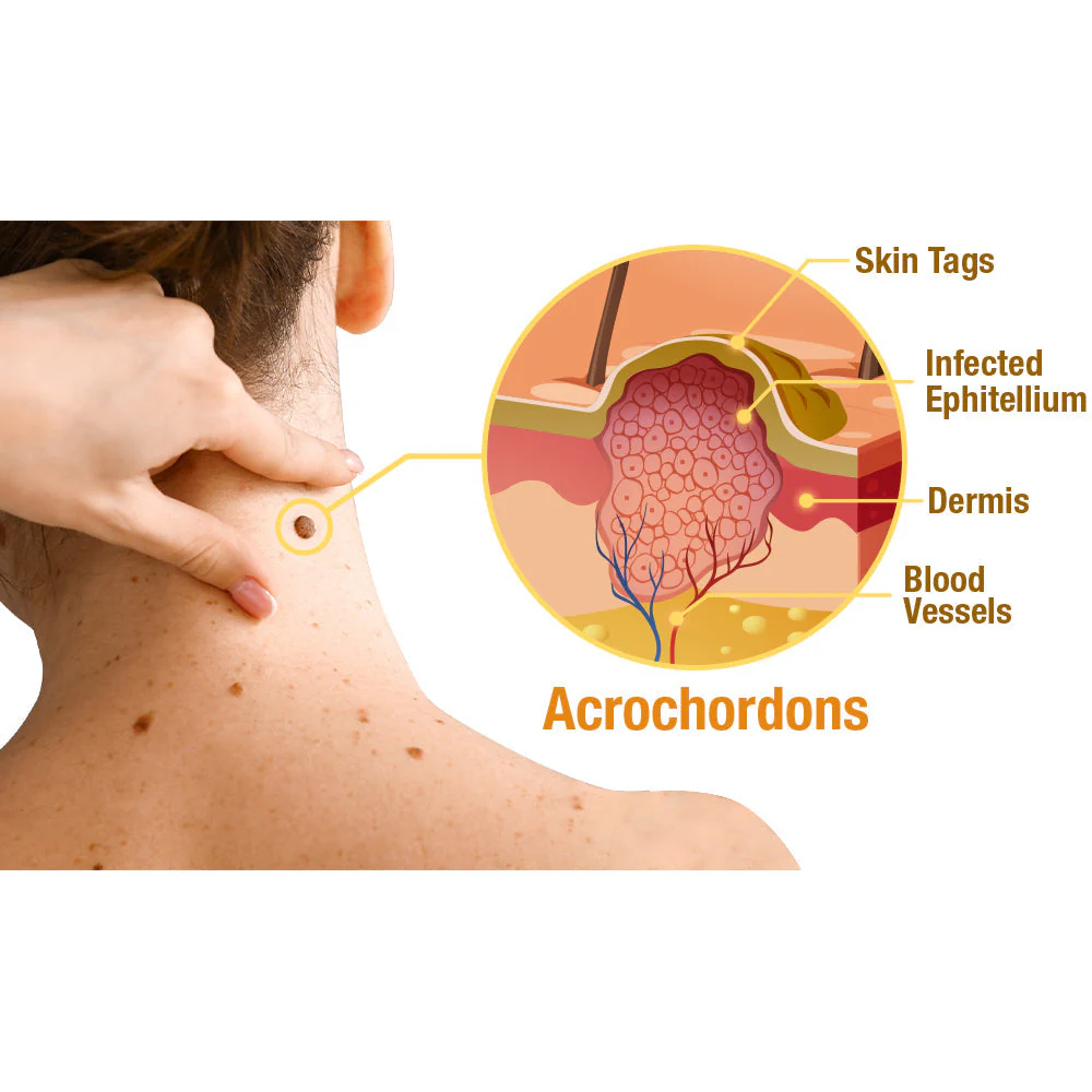 flysmus™ TagRecede Bee Venom Treatment Spray - Image 6