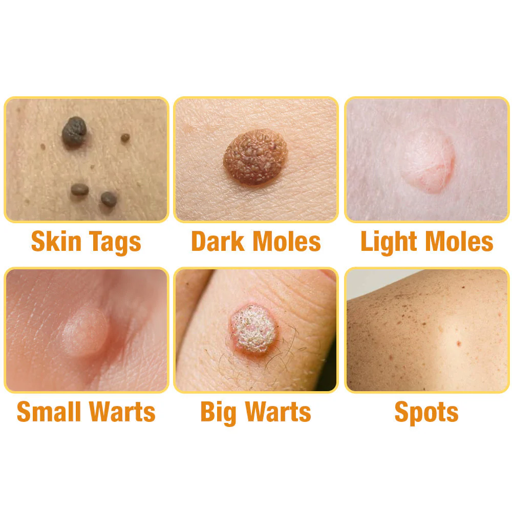 flysmus™ TagRecede Bee Venom Treatment Spray - Image 7