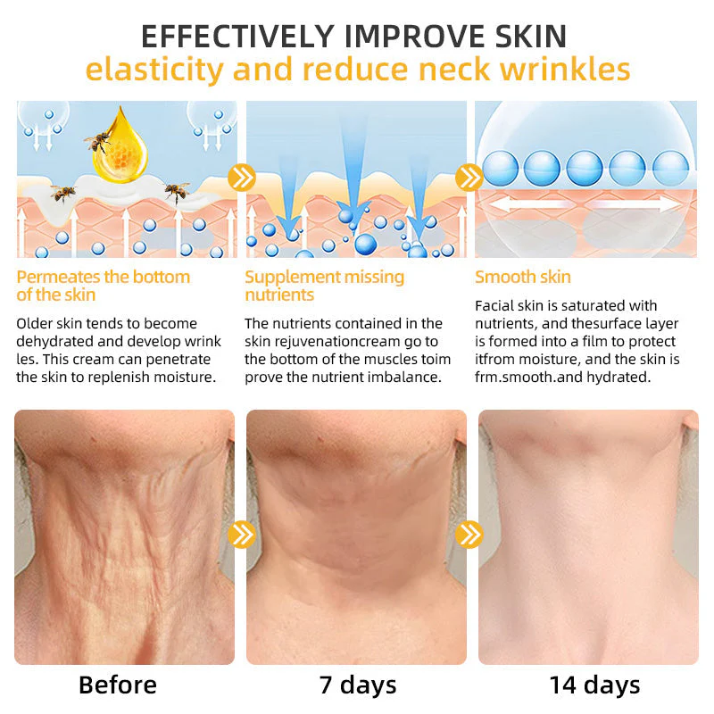 Flysmus⢠BeeLift Anti-Aging Firming Cream,Address Crepe & Sagging(đĽ74% Off for a Limited Time!) - Image 10
