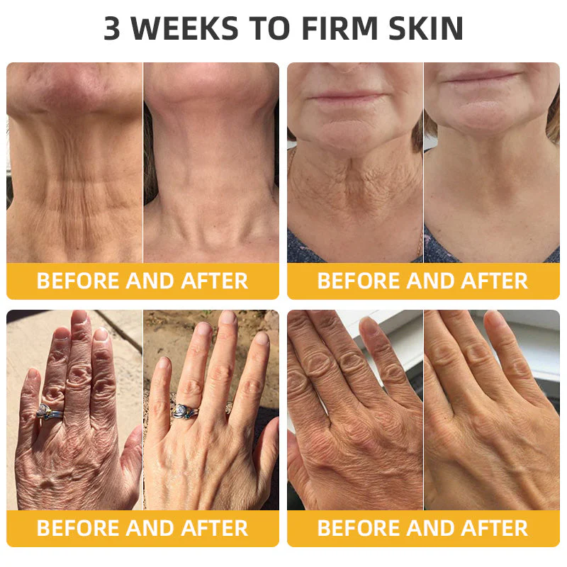 Flysmus⢠BeeLift Anti-Aging Firming Cream,Address Crepe & Sagging(đĽ74% Off for a Limited Time!) - Image 3