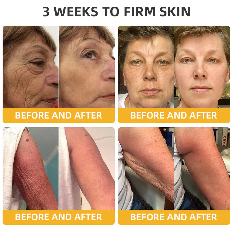 Flysmus⢠BeeLift Anti-Aging Firming Cream,Address Crepe & Sagging(đĽ74% Off for a Limited Time!) - Image 4