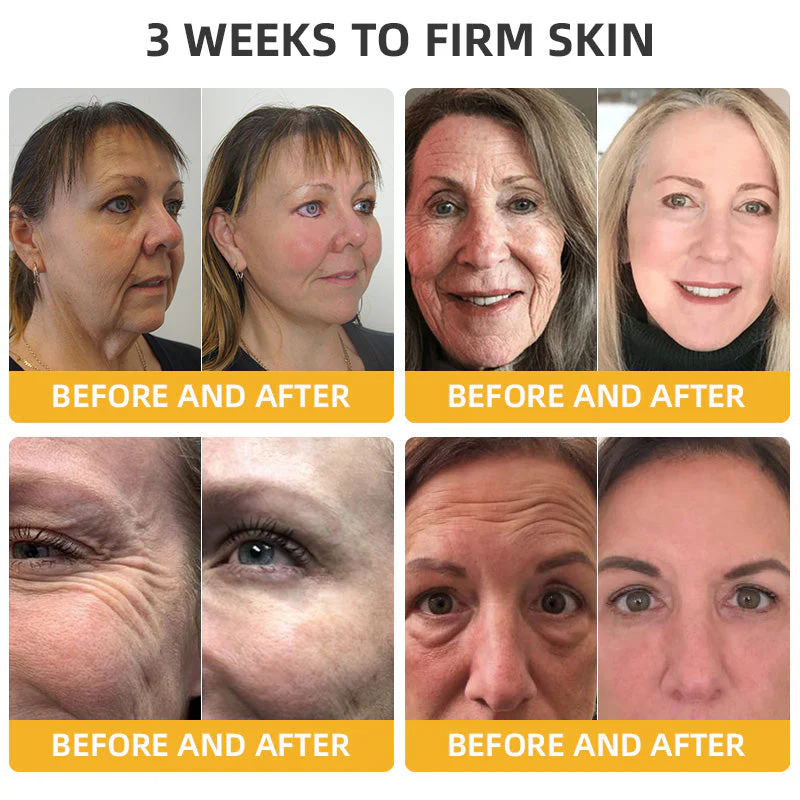 Flysmus⢠BeeLift Anti-Aging Firming Cream,Address Crepe & Sagging(đĽ74% Off for a Limited Time!) - Image 5