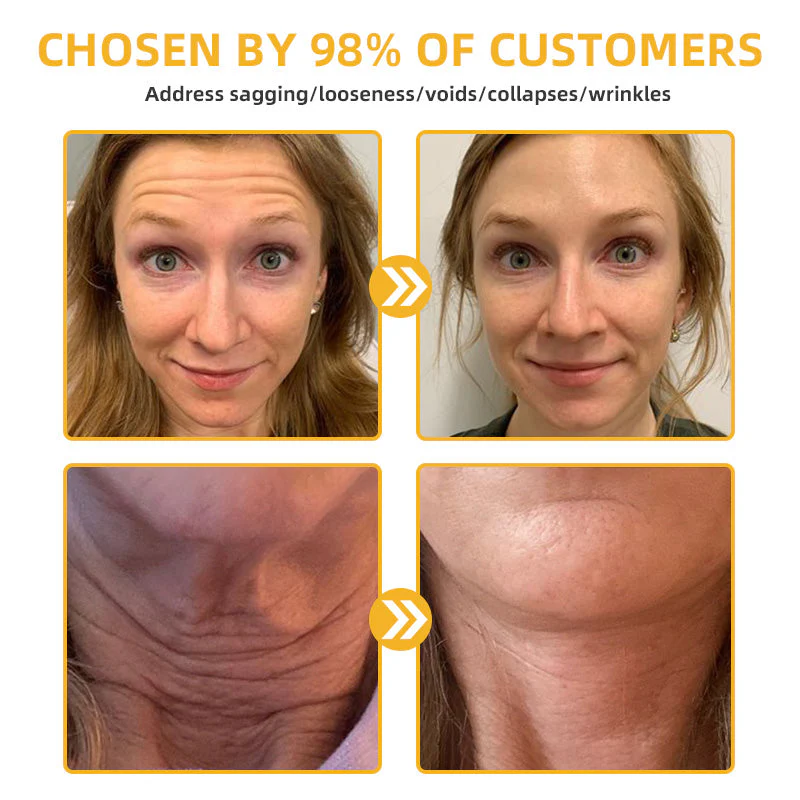 Flysmus⢠BeeLift Anti-Aging Firming Cream,Address Crepe & Sagging(đĽ74% Off for a Limited Time!) - Image 6
