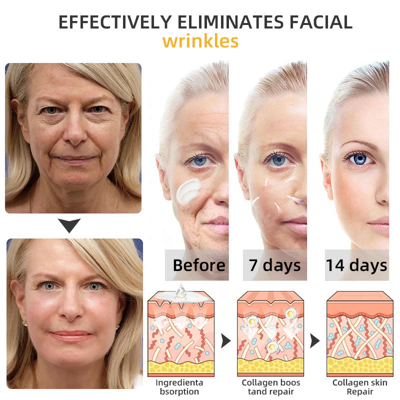 Flysmus⢠BeeLift Anti-Aging Firming Cream,Address Crepe & Sagging(đĽ74% Off for a Limited Time!) - Image 9