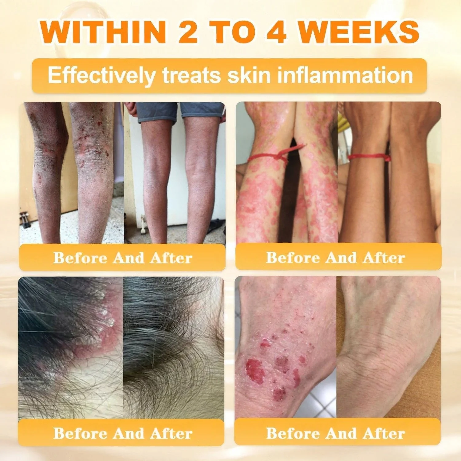 FDA Approved|Rolimey® Bee Venom Skin Restoration Cream (Anti-aging, Hydrating, Skin Repair, Even Tone, Acne and Dark Spot Treatment, Wart and Mole Removal, Psoriasis Relief) - Image 6