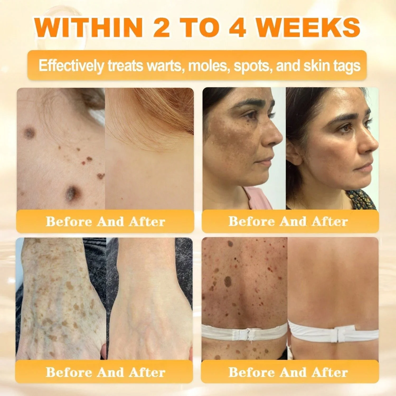 FDA Approved|Rolimey® Bee Venom Skin Restoration Cream (Anti-aging, Hydrating, Skin Repair, Even Tone, Acne and Dark Spot Treatment, Wart and Mole Removal, Psoriasis Relief) - Image 9