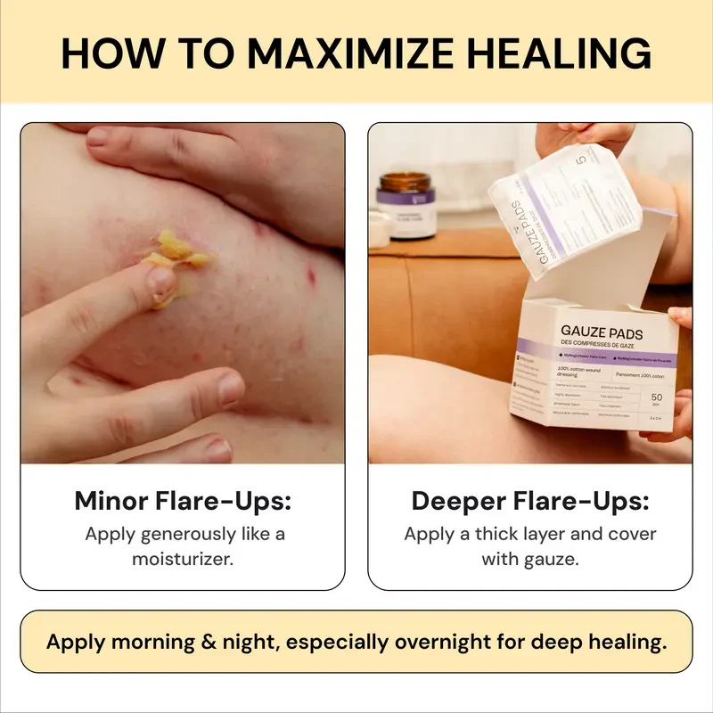 Flysmus®Tea Tree Flare Care| Cystic Acne and Bumps Treatment Skincare Daily Pimple - Image 7