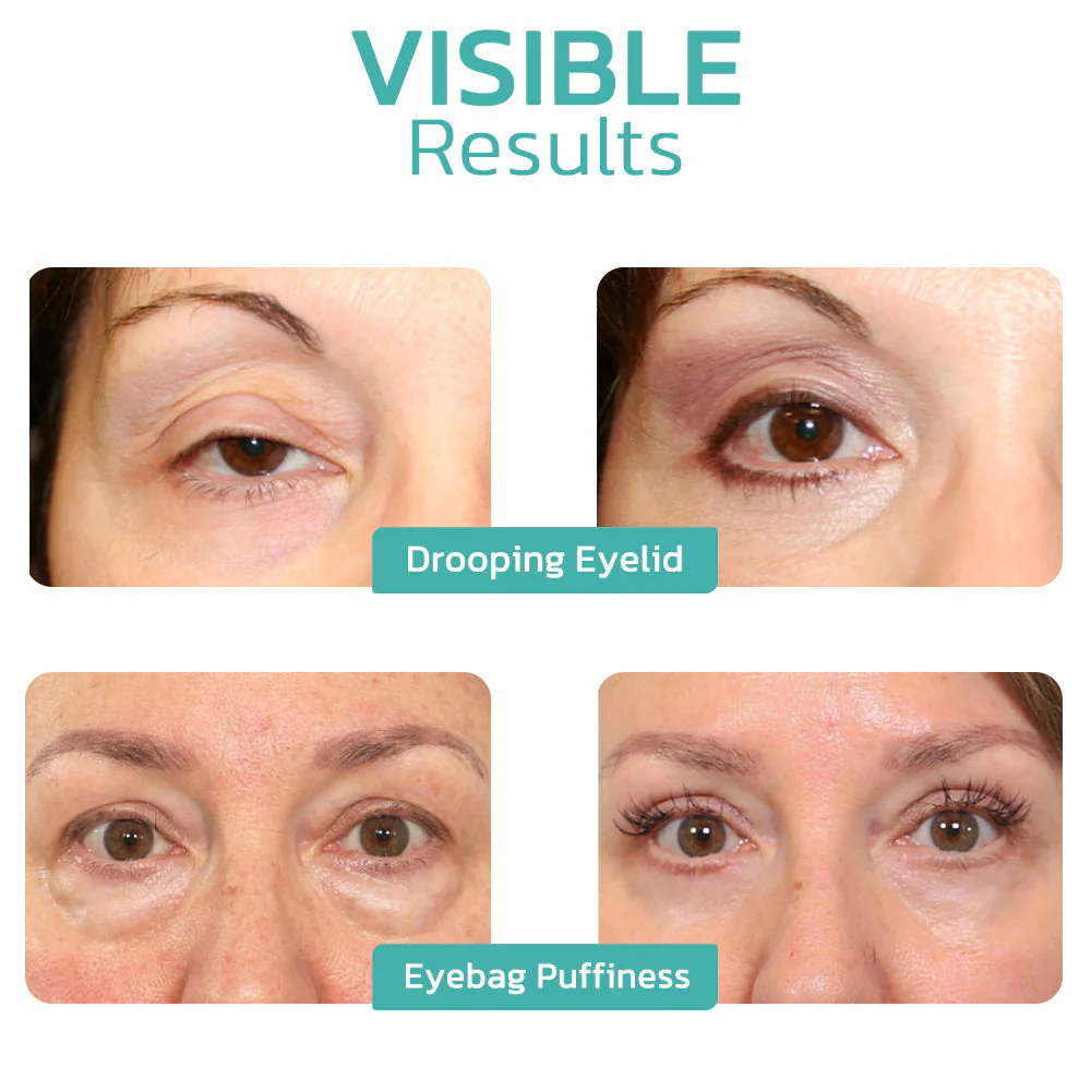 Furzero⢠CELYN Peptide Taut Eye Cream - Image 7